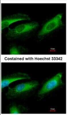 Immunocytochemistry/ Immunofluorescence: Pirh2 Antibody [NBP2-19839]