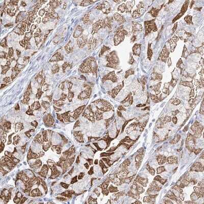 Immunohistochemistry-Paraffin: Pirh2 Antibody [NBP1-90098]