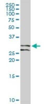 Western Blot: Pirh2 Antibody [H00025898-D01P]