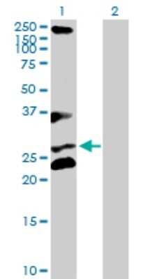 Western Blot: Pirh2 Antibody [H00025898-D01P]