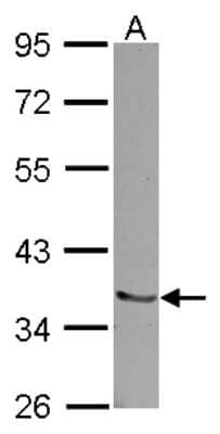 Western Blot: Pirh2 Antibody [NBP2-19839]