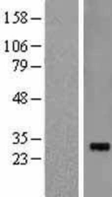 Western Blot: Pirh2 Overexpression Lysate [NBL1-15244]