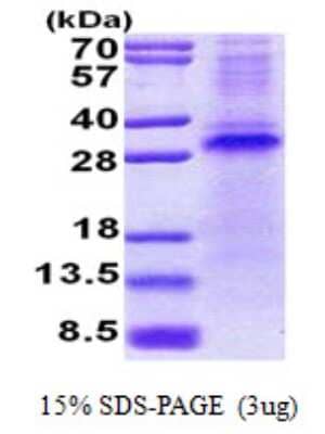 SDS-PAGE: Recombinant Human Pirh2 His Protein [NBP2-23438]