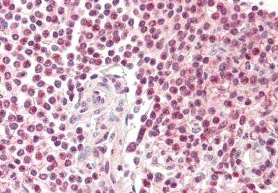Immunohistochemistry-Paraffin: Pirin Antibody [NB300-958]