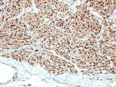 Immunohistochemistry-Paraffin: Pirin Antibody [NBP2-19840]