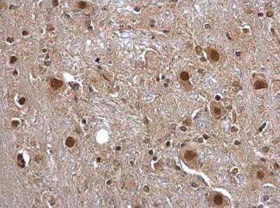 Immunohistochemistry-Paraffin: Pirin Antibody [NBP2-19840]