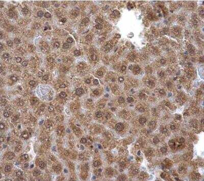 Immunohistochemistry-Paraffin: Pirin Antibody [NBP2-19840]