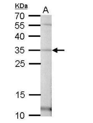 Western Blot: Pirin Antibody [NBP2-19840]