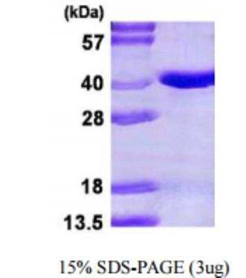 SDS-PAGE: Recombinant Human Pirin His Protein [NBP1-99104]