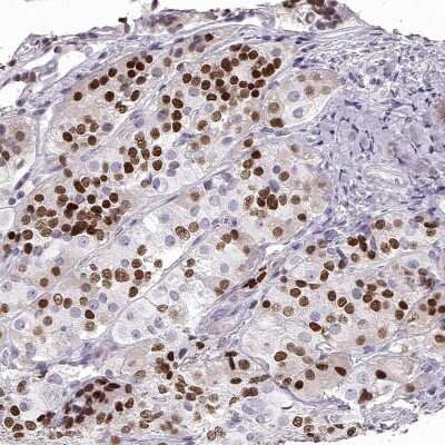 Immunohistochemistry-Paraffin: Pit1 Antibody [NBP1-92273]