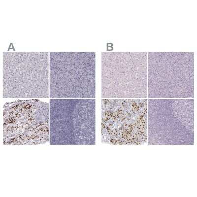 Immunohistochemistry-Paraffin: Pit1 Antibody [NBP1-92273]