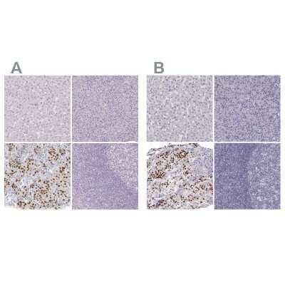 Immunohistochemistry-Paraffin: Pit1 Antibody [NBP2-55357]