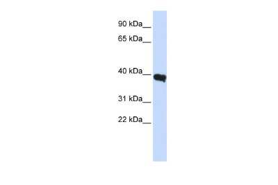 Western Blot: Pit1 Antibody [NBP2-85478]