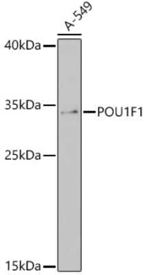 Western Blot: Pit1 AntibodyAzide and BSA Free [NBP3-03868]