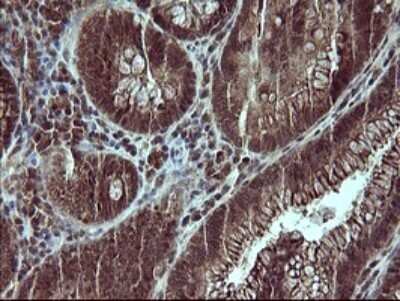 Immunohistochemistry: Placental Lactogen/CSH1 Antibody (OTI2G4) [NBP2-46376]
