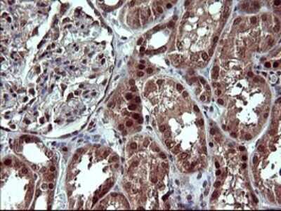 Immunohistochemistry: Placental Lactogen/CSH1 Antibody (OTI2G4) [NBP2-46376]
