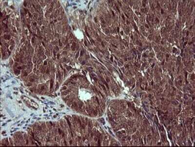 Immunohistochemistry: Placental Lactogen/CSH1 Antibody (OTI2G4) [NBP2-46376]