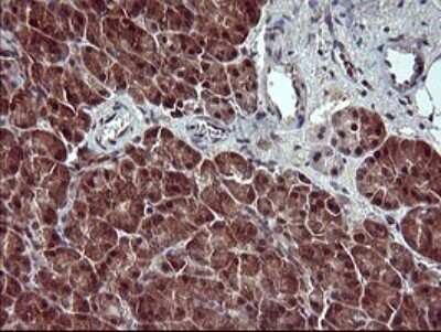 Immunohistochemistry: Placental Lactogen/CSH1 Antibody (OTI2G4) [NBP2-46376]