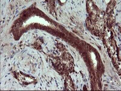 Immunohistochemistry: Placental Lactogen/CSH1 Antibody (OTI2G4) [NBP2-46376]