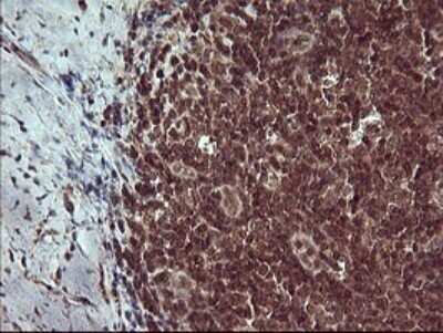 Immunohistochemistry: Placental Lactogen/CSH1 Antibody (OTI2G4) [NBP2-46376]
