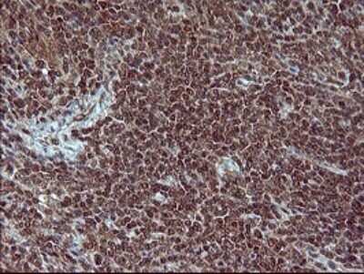 Immunohistochemistry: Placental Lactogen/CSH1 Antibody (OTI2G4) [NBP2-46376]