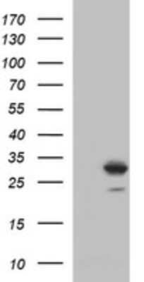 Western Blot: Placental Lactogen/CSH1 Antibody (OTI2G4) [NBP2-46376]