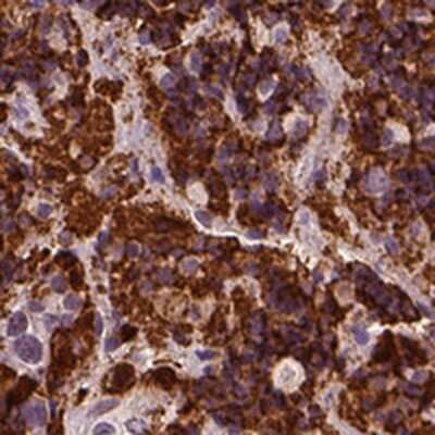 Immunohistochemistry-Paraffin: Placental Lactogen/CSH1 Antibody [NBP2-54710]