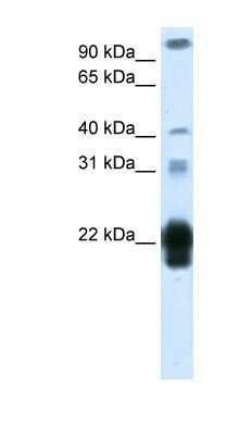 Western Blot: Placental Lactogen/CSH1 Antibody [NBP1-59302]