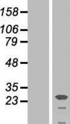 Western Blot: Placental Lactogen/CSH1 Overexpression Lysate [NBP2-06423]