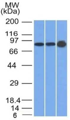 Western Blot: Plakophilin 1 Antibody (10B2)Azide and BSA Free [NBP2-54526]