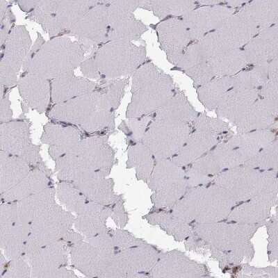 Immunohistochemistry-Paraffin: Plakophilin 1 Antibody [NBP1-90042]