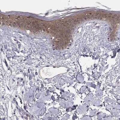 Immunohistochemistry-Paraffin: Plakophilin 1 Antibody [NBP1-90042]