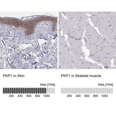 Immunohistochemistry-Paraffin: Plakophilin 1 Antibody [NBP1-90042]