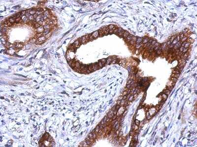 Immunohistochemistry-Paraffin: Plakophilin 1 Antibody [NBP2-19857]