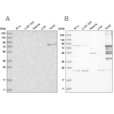 Western Blot: Plakophilin 1 Antibody [NBP1-90041]