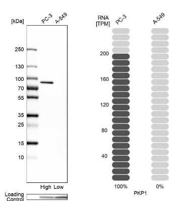 Western Blot: Plakophilin 1 Antibody [NBP1-90042]
