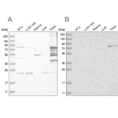 Western Blot: Plakophilin 1 Antibody [NBP1-90042]
