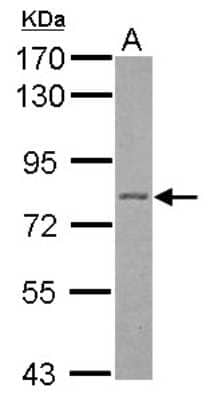 Western Blot: Plakophilin 1 Antibody [NBP2-19857]