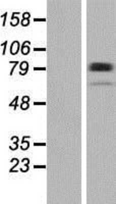 Western Blot: Plakophilin 1 Overexpression Lysate [NBP2-10739]