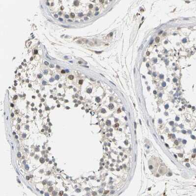 Immunohistochemistry-Paraffin: Plakophilin 2 Antibody [NBP1-86078]