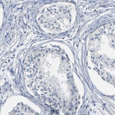 Immunohistochemistry-Paraffin: Plakophilin 2 Antibody [NBP1-86078]