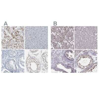Immunohistochemistry-Paraffin: Plakophilin 2 Antibody [NBP1-86078]