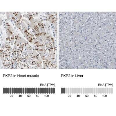 Immunohistochemistry-Paraffin: Plakophilin 2 Antibody [NBP1-86078]