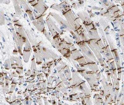Immunohistochemistry-Paraffin: Plakophilin 2 Antibody [NBP1-86078]