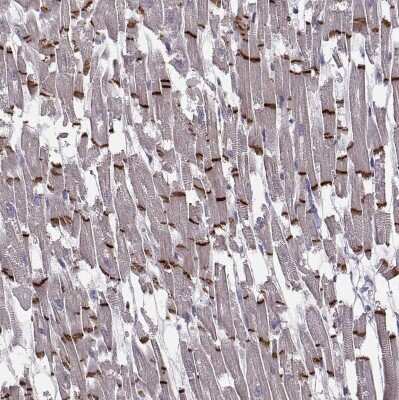 Immunohistochemistry-Paraffin: Plakophilin 2 Antibody [NBP2-58748]