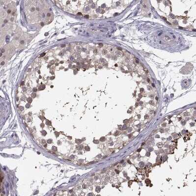 Immunohistochemistry-Paraffin: Plakophilin 2 Antibody [NBP2-58748]