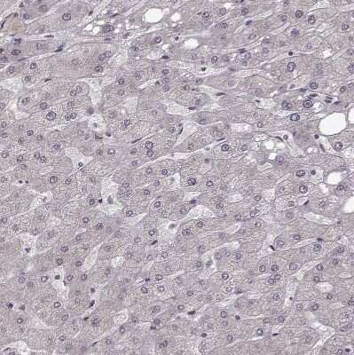 Immunohistochemistry-Paraffin: Plakophilin 2 Antibody [NBP2-58748]