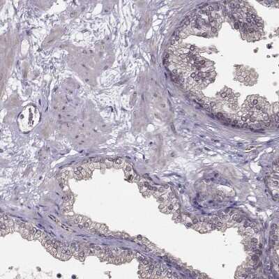 Immunohistochemistry-Paraffin: Plakophilin 2 Antibody [NBP2-58748]