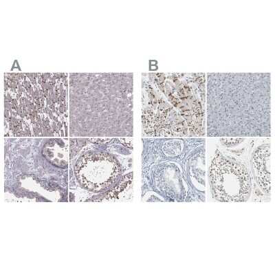 Immunohistochemistry-Paraffin: Plakophilin 2 Antibody [NBP2-58748]
