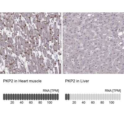 Immunohistochemistry-Paraffin: Plakophilin 2 Antibody [NBP2-58748]